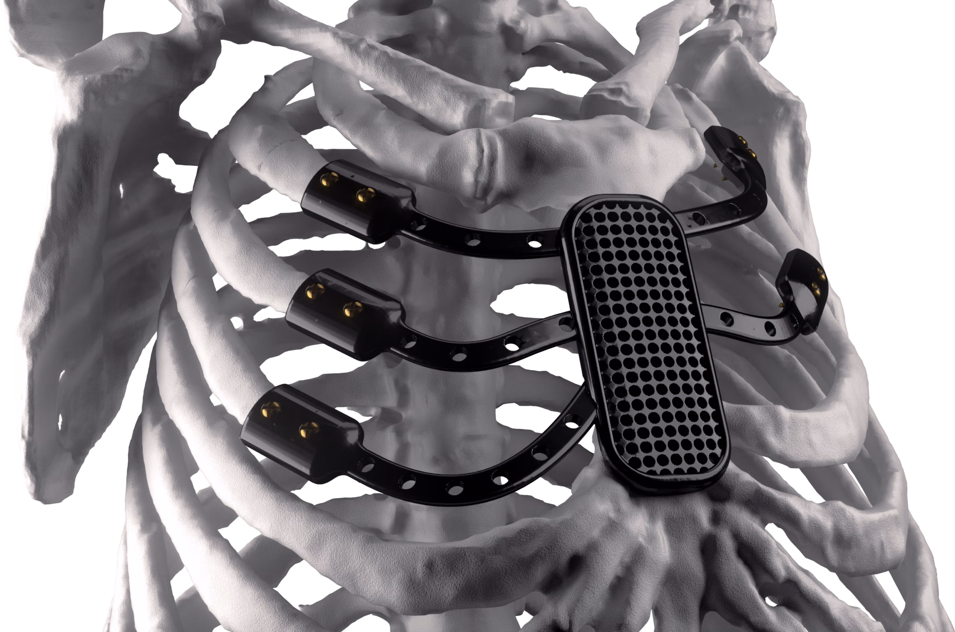 Orthopedics solution area